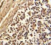 IHC analysis of FFPE human lymph with CD33 antibody