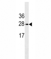 Erythropoietin antibody western blot analysis in K562 lysate. Expected molecular weight: 18-34 kDa depending on glycosylation level.