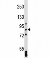 SATB2 antibody western blot analysis in MCF-7 lysate