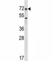 Bmpr1a antibody western blot analysis in SK-BR-3 lysate. Predicted molecular weight ~60kDa.