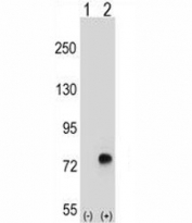 Western blot analysis of TGFBI antibody and 293 cell lysate either nontransfected (Lane 1) or transiently transfected (2) with the TGFBI gene.