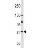 ACOX2 antibody western blot analysis in A375 lysate. Predicted molecular weight: ~75kDa.
