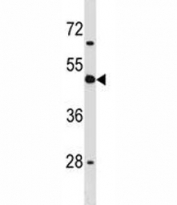 CD1d antibody western blot analysis in K562 lysate