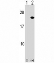 Western blot analysis of ARF5 antibody and 293 cell lysate either nontransfected (Lane 1) or transiently transfected (2) with the ARF5 gene.