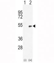 Western blot analysis of BMP4 antibody and 293 cell lysate (2 ug/lane) either nontransfected (Lane 1) or transiently transfected (2) with the BMP4 gene.