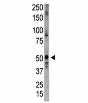Western blot testing of BMPR antibody and placenta tissue lysate.