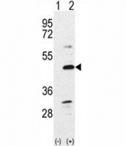 Western blot analysis of BMP7 antibody and 293 cell lysate either nontransfected (Lane 1) or transiently transfected with the BMP7 gene (2). Predicted molecular weight: 49 kDa protein cleaved into ~33 and ~15 kDa segments.