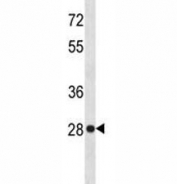 HMGB-1 antibody western blot analysis in HeLa lysate. Predicted molecular weight ~25 kDa.