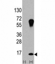 Western blot analysis of LC3A antibody and 293 cell lysate (2 ug/lane) either nontransfected (Lane 1) or transiently transfected with the LC3A/APG8a gene (2).