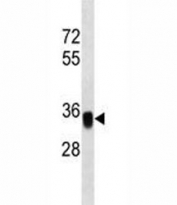 EpCAM antibody western blot analysis in MDA-MB453 lysate. Expected molecular weight: ~35 kDa (unmodified), 40-43 kDa (glycosylated).