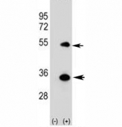 Western blot analysis of ATG5 antibody and 293 cell lysate (2 ug/lane) either nontransfected (Lane 1) or transiently transfected (2) with the human gene. Predicted molecular weight ATG5: ~32 kDa; ATG5/ATG12 heterodimer: ~56 kDa.