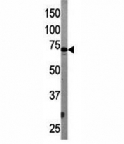 Western blot testing of APG7 antibody and mouse liver tissue lysate. Predicted molecular weight: 70-80 kDa.
