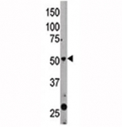 The Beclin 1 antibody used in western blot to detect BECN1 in mouse liver tissue lysate