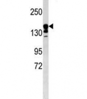 ABCC9 antibody western blot analysis in mouse kidney tissue lysate. Predicted molecular weight ~174 kDa.