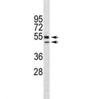 VDR antibody western blot analysis in HL-60 lysate. Predicted molecular weight 48/54 kDa (isoforms 1/2).