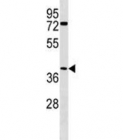 ABHD1 antibody western blot analysis in human MDA-MB468 lysate. Predicted molecular weight ~45 kDa.