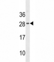 EPO antibody western blot analysis in WiDr lysate. Predicted molecular weight: 18-34 kDa depending on glycosylation level.