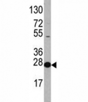 Western blot analysis of EIF4E antibody and HL-60 lysate. Predicted molecular weight ~27 kDa.