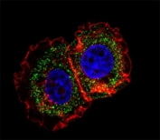 Fluorescent confocal image of MCF-7 cell stained with ER antibody at 1:25. Immunoreactivity is localized to the cytoplasm.