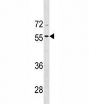 BMP8A antibody western blot analysis in CEM lysate