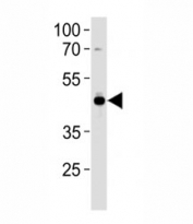 AP2 antibody western blot analysis in U251 lysate. Predicted molecular weight ~47 kDa.