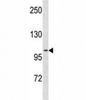 PR antibody western blot analysis in ZR-75-1 lysate. Expected molecular weight: 82-94 kDa (isoform A) and 99-120 kDa (isoform B).