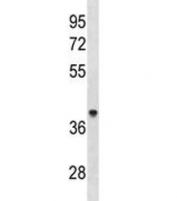 ACAA1 antibody western blot analysis in human 293 lysate. Predicted molecular weight ~44 kDa.