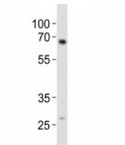 Western blot analysis of lysate from mouse kidney tissue using ALK3 antibody diluted at 1:1000.