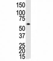 Western blot analysis of ALK3 antibody and human Saos-2 cell lysate. Predicted molecular weight ~60 kDa.
