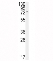 Western blot analysis of BMPR1A antibody and 293 lysate