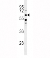 ALK3 western blot analysis in HeLa lysate. Predicted molecular weight ~60 kDa.