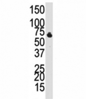 Western blot analysis of BMPR1B antibody and NCI-H460 cell lysate. Predicted molecular weight 55-60 kDa.