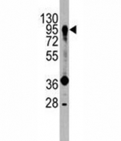 Western blot analysis of PROX1 antibody and HepG2 lysate.