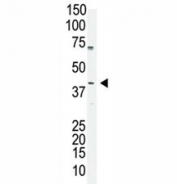 Oct4 antibody used in western blot to detect OCT4 in A375 cell lysate. Predicted molecular weight ~38/30kDa (isoform A/B), commonly observed at 38-45 kDa.