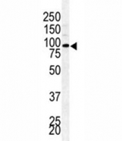 Western blot analysis of BAP1 antibody and mouse testis lysate. Expected molecular weight: 80-100 kDa.