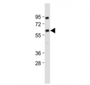 Western blot testing of human MOLT4 cell lysate with YY1 antibody. Predicted molecular weight ~45 kDa but commonly observed at 45~65 kDa.