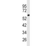 Western blot analysis of ACSL3 antibody and human 293 lysate. Predicted molecular weight ~80 kDa.