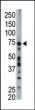 FACL6 antibody used in western blot to detect FACL6 in mouse liver tissue lysate