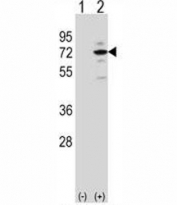 Western blot analysis of MeCP2 antibody and 293 cell lysate (2 ug/lane) either nontransfected (Lane 1) or transiently transfected (2) with the MeCP2 gene. Observed molecular weight: ~55 kDa and ~75 kDa.