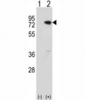 Western blot analysis of MeCP2 antibody and 293 cell lysate (2 ug/lane) either nontransfected (Lane 1) or transiently transfected (2) with the MeCP2 gene. Observed molecular weight: ~55 kDa and ~75 kDa.