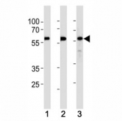 KLF4 antibody western blot analysis in (1) HeLa,(2) MCF-7 and (3) SW480 lysate. Predicted molecular weight: 50-60 kDa + possible ~75 kDa (phosphorylated form).