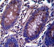 Anti-Vimentin antibody immunohistochemistry analysis in formalin fixed and paraffin embedded human colon tissue.