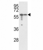 Western blot analysis of VIM antibody and A2058, A375 lysate.