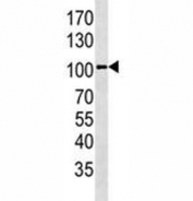 GPR49 antibody western blot analysis in HepG2 lysate