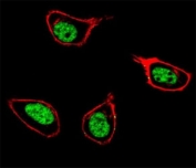 Confocal immunofluorescent analysis of PCNA antibody with 293 cells followed by Alexa Fluor 488-conjugated goat anti-rabbit lgG (green). Actin filaments have been labeled with Alexa Fluor 555 Phalloidin (red). DAPI was used as a nuclear counterstain (blue).