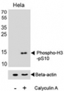 Western blot analysis of lysate from HeLa cell line, untreated or treated with Calyculin A (100ng/ml), using phospho-Histone H3 antibody
