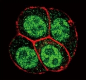 Confocal immunofluorescent analysis of phospho-SMAD2 antibody with HeLa cells followed by Alexa Fluor 488-conjugated goat anti-rabbit lgG (green). Actin filaments have been labeled with Alexa Fluor 555 Phalloidin (red).