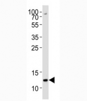Western blot analysis of lysate from K562 cell line using H4 antibody diluted at 1:1000 for each lane.