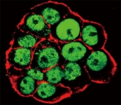 Confocal immunofluorescent analysis of phospho CDX2 antibody and WiDr cells followed by Alexa Fluor 488-conjugated goat anti-rabbit lgG (green). Actin filaments have been labeled with Alexa Fluor 555 Phalloidin (red).
