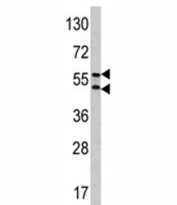 Western blot analysis of CA9 antibody and HeLa lysate. Predicted molecular weight: 58 kDa and 54 kDa (soluble form).